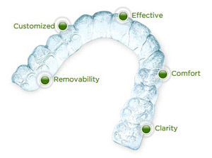 Invisalign aligners